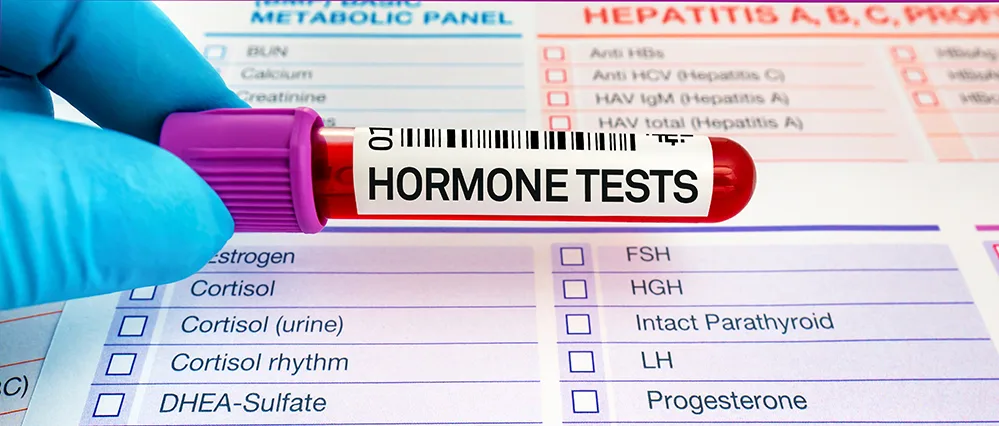 Top 4 Restful Sleep Strategies Tailored for the 50+ Body 2 A labeled blood test vial marked “hormones,” symbolizing the role of testing in managing age-related sleep disruptions.